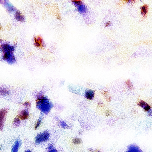 成人性爱外国网站
